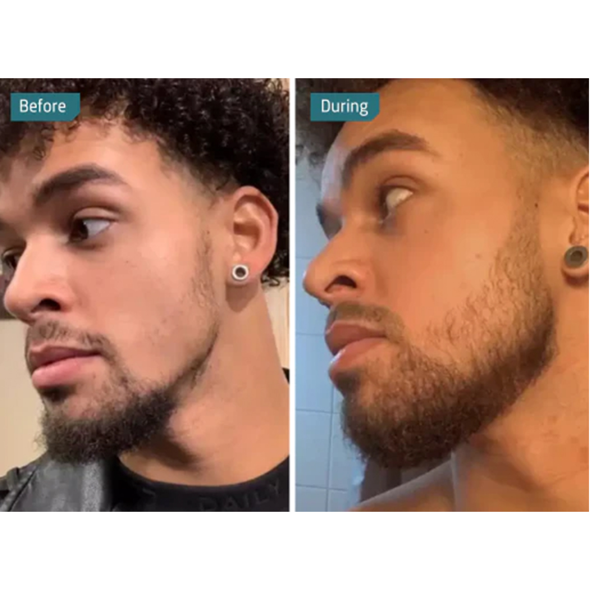 Neofollics - Beard Growth Supporting Tablets, foto 2 van 4